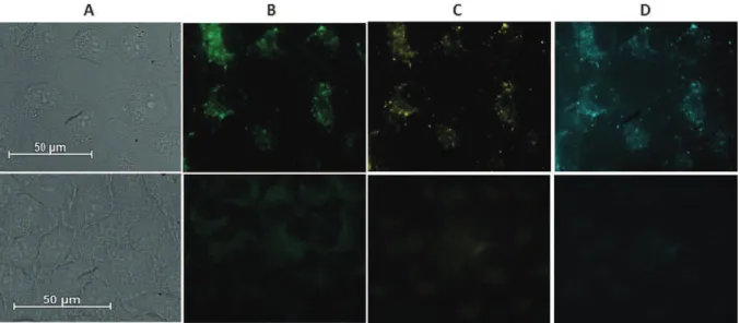 Figure I - 37 : Microscopie d’épifluorescence de cellules HeLa. Haut : après incubation avec le complexe de  samarium, Bas : cellules non traitées
