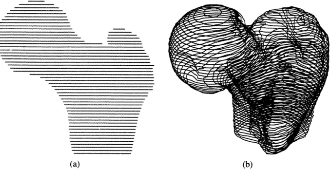 Figure 2.6:  Ring-Stack Display of Proximal Femur in Neutral (a) and Rotated (b) Positions.