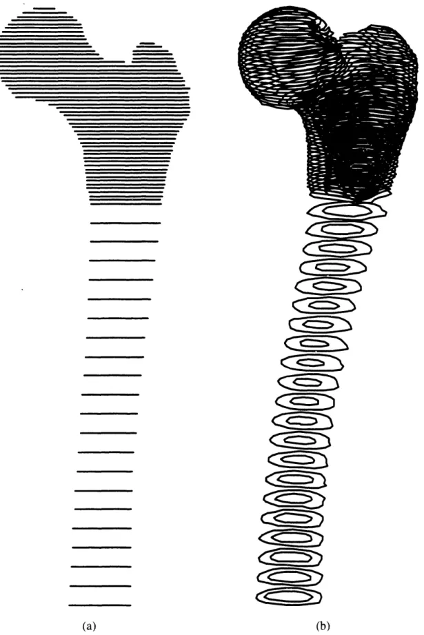 Figure 2.7: Ring-Stack Display of Femur in Neutral (a) and Rotated (b) Scanner Positions with Coarse Shaft Data.