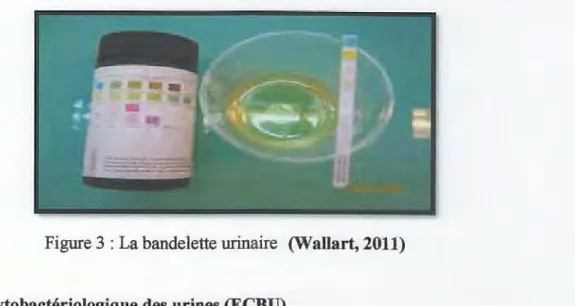 Figure 3 : La bandelette urinaire  (Wallart, 2011) 