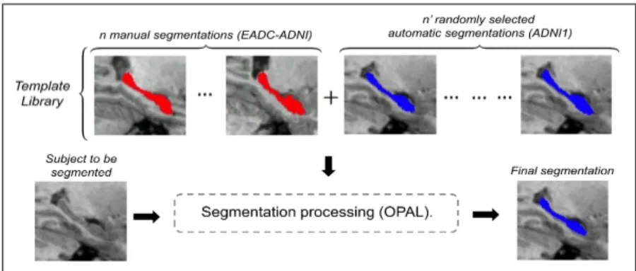 Figure 9: Addition of new segmented subjects to the template library. The automatic seg- seg-mentation of new subjects provided without manual expert segseg-mentations can be added to the template library in order to increase its size and diversity