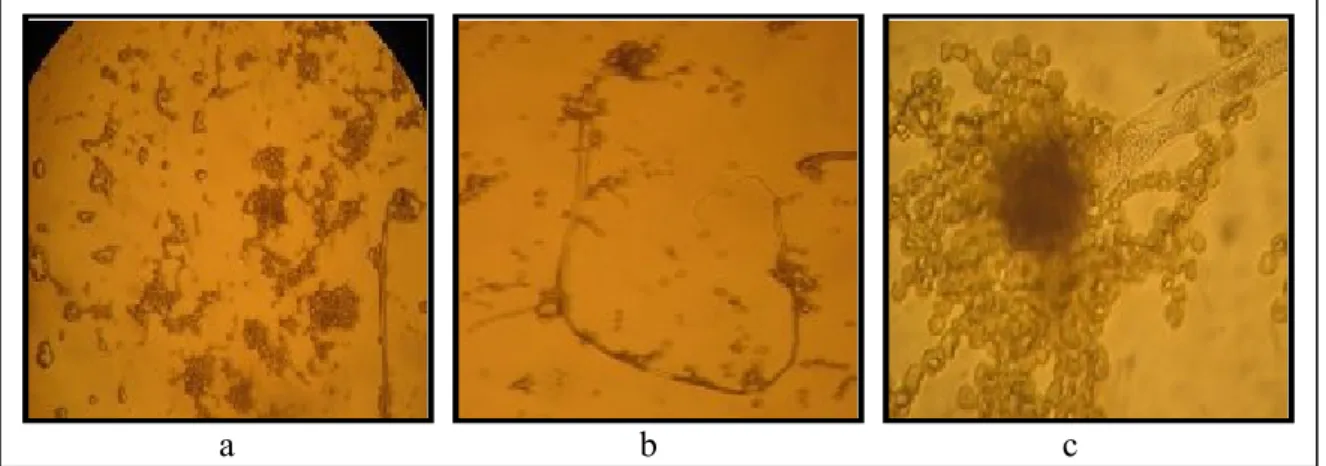 Figure 9. Aspect des colonies de la souche S12 5  sous microscope optique.