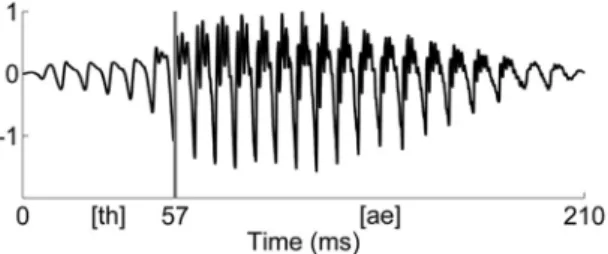 Figure 4.  Fast Fourier transform computed on the whole stimulus (normalized amplitude)