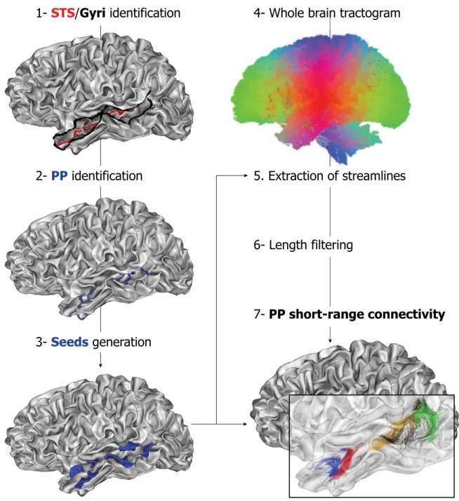 Fig. 1. Analysis pipeline for U-shape ﬁbers extraction illustrated for one subject in the left hemisphere