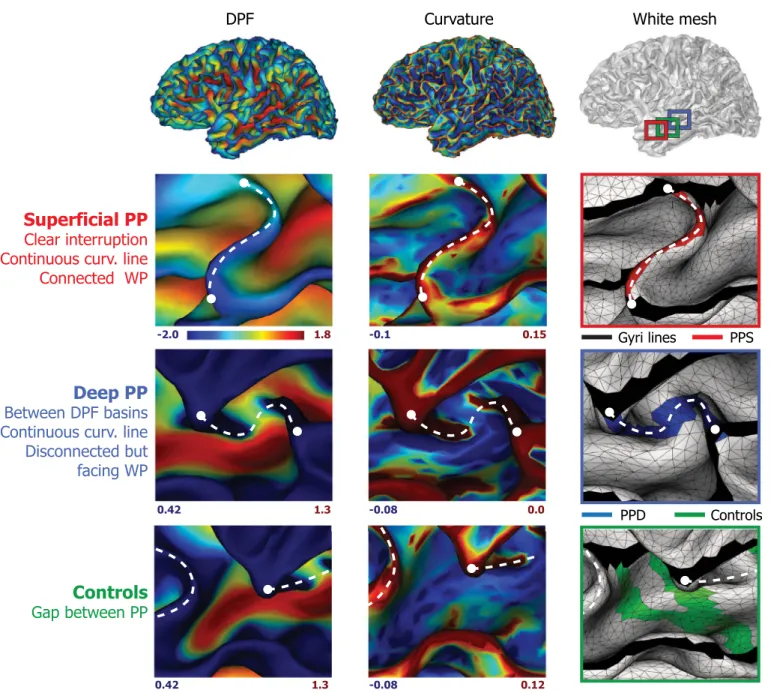 Fig. 3. Methods for PPs identiﬁcation, illustrated for one subject in the left hemisphere