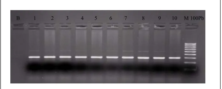 Figure 13: Profil d’électrophorèse  sur gel d’agarose 1,5 % des fragments amplifiés (198pb)   par  PCR du gène de la MTHFR