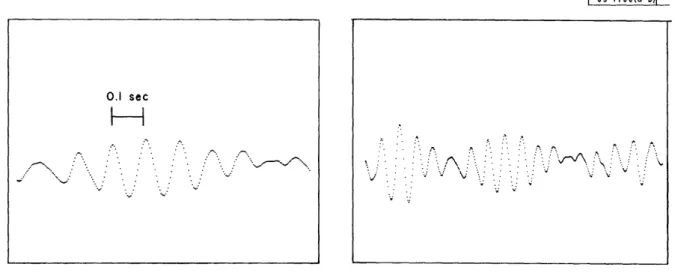 Fig.  (a).  A  classical&#34;  rhythmic  burst.  Fig.  (b).  Same  burst  on  compressed  time  scale.