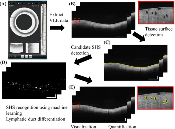 Figure 1. Fully automated algorithm for subsurface hyposcattering structure (SHS) detection and  quantification