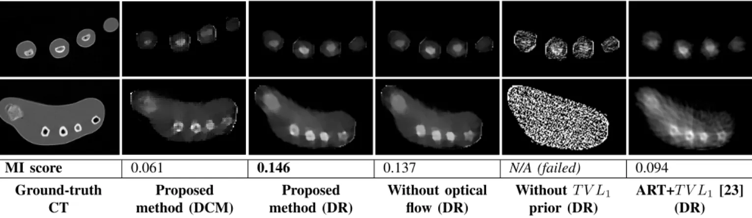Fig. 16. Results on the forearm phantom: 2 selected slices and Mutual Information (MI) score for both DR and DCM datasets