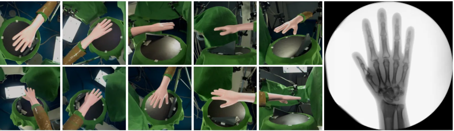 Fig. 5. Example of input at a given frame on the forearm phantom. Left: ten video images (2048×2048) from different view points, right: one radiographic image (1024×1024)
