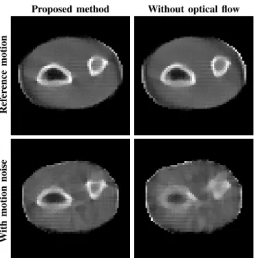 Fig. 13. Results on synthetic data over 32 frames with added sample motion noise (variance: 0.2, intensity: 5.0mm)