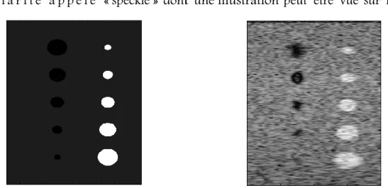 Figure I.2. On  y représente  une  image  synthétique ainsi que sa simulation   échographique