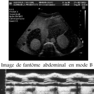 Figure I.10. Image  de fantôme  abdominal  en mode B 