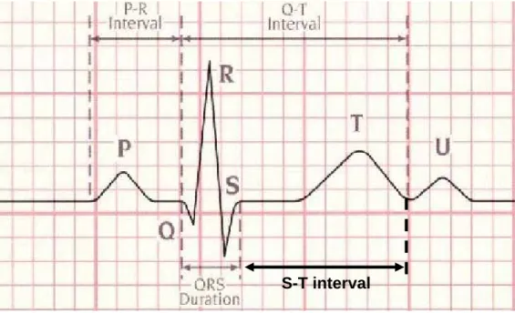 Figure 1.6. Différents intervalles dans l’ECG.   