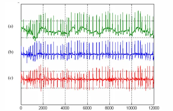 Figure 3.7. Résultat du filtrage blanchissant par PMC et PRNN du fichier 203 de MIT/BIH