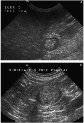 Fig 4. Ultrasound measurements of the maximal dorsoventral thickness of the larger adrenal glands (LDV) (mm) in 28 dogs with ADHAC (white diamonds) and in 19 dogs with AIHAC (black  di-amonds) with EAA