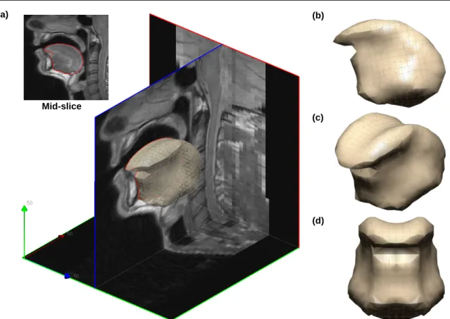 Fig. 3 (a) Atlas MR data superimposed with the 3D atlas FE tongue mesh, (b) Side, (c) isometric and (d) front views respectively of the 3D FE tongue mesh.