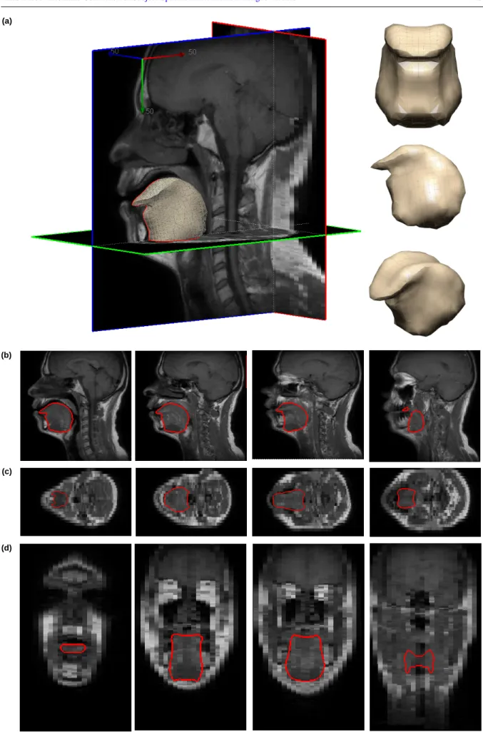 Fig. 7 Mesh derived tongue contours superimposed on the MR image: (a) 3D subject-specific FE tongue mesh (Normal #1), (b) Sagittal views (mid-sagittal to the lateral side), (c) Axial views (inferior to superior), (d) Coronal views (anterior to posterior).