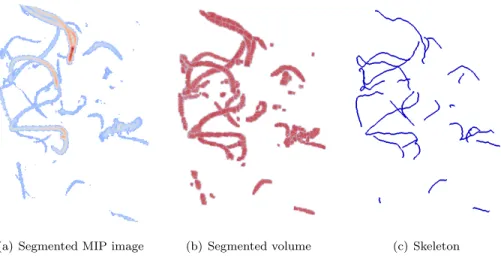 Figure 4: Blood vessels extraction from MRA
