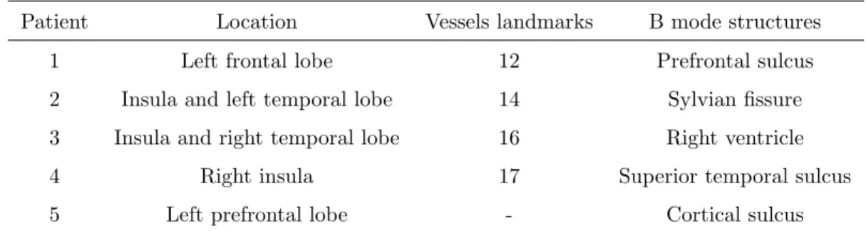 Table 2: Clinical cases, all of them operated for a low-grade tumor. For the validation, the segmented anatomical structure and the number of landmarks identified on blood vessels are given for each case.