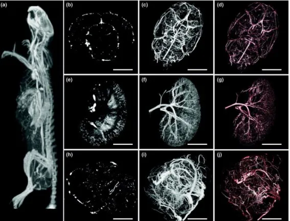 Figure 5. Micrographs of micro-CT images in vasculature imaging. (A) A micro-CT projection through a clinical CT image of the  intact rat