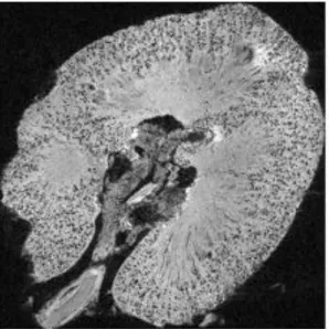 Figure  6.  Micrograph  of  a  2D  projection  of  3D  MR  image  of  a  human  kidney  injected  with  labelling  image  agent  for  the  visualization of glomeruli