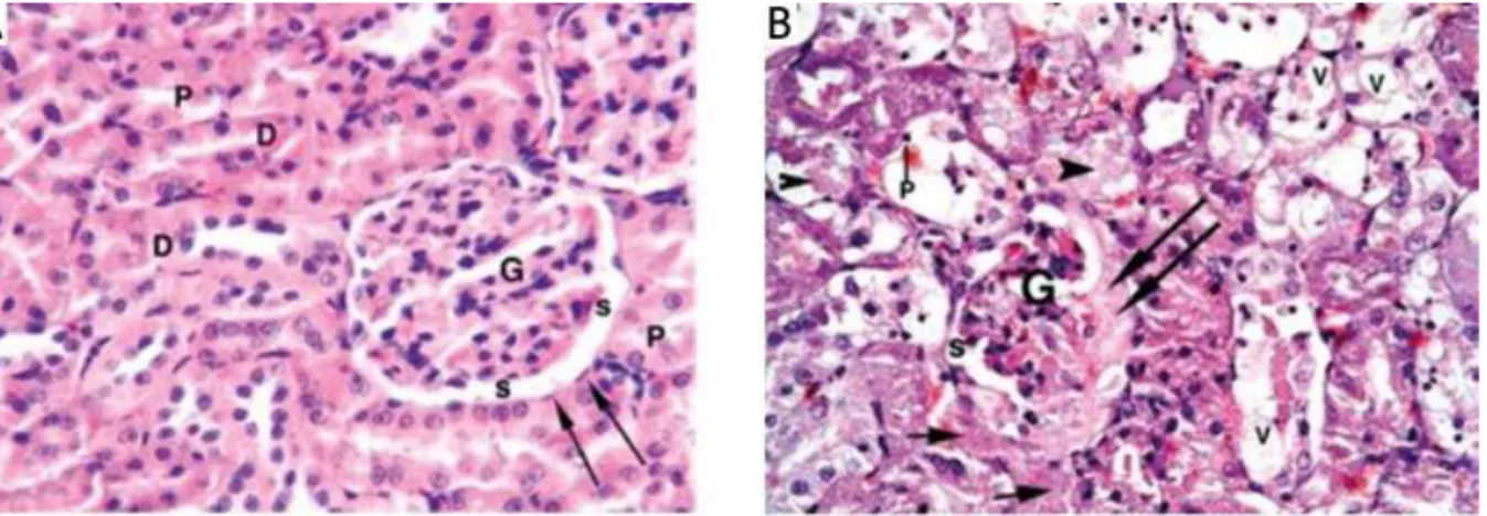 Figure 8. H&amp;E stained micrographs of renal tissue. (A) Normal glomerulus (G), parietal layer of Bowman's capsule (arrows) and  urinary spaces (s) in a control rat