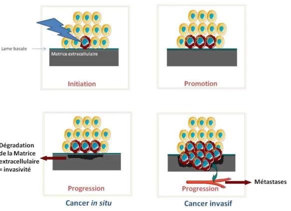 Figure 2 : Schéma illustrant les étapes de la cancérisation.  