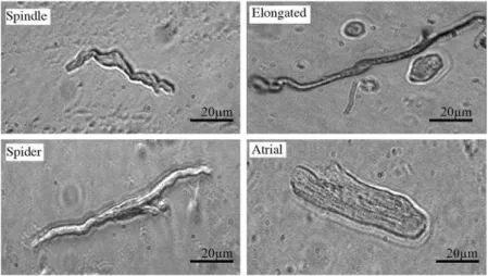 Figure  3 :  Morphologie  des cellules  isolées  de  SAN  de  souris.  Spindle :  cellule  en  fuseau,  Elongated :  cellule en forme d’araignée, Spider : cellule en forme allongée, Atrial : cellule atriale