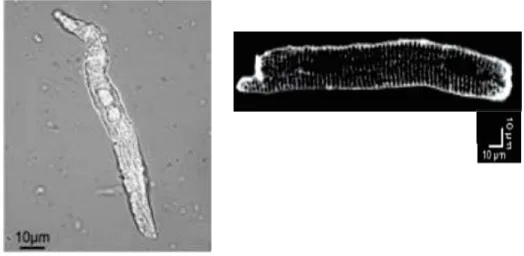 Figure 6 :   Photo de gauche : Morphologie des cellules des fibres de Purkinje de souris (Miquerol  et al., 2004)