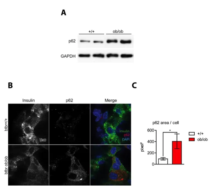 Figure 18. Autophagic flux is decreased in diabetic β-cells. (A) Immunoblot with lysates from  isolated islets from control (+/+) or diabetic (ob/ob) mice using an antibody against p62