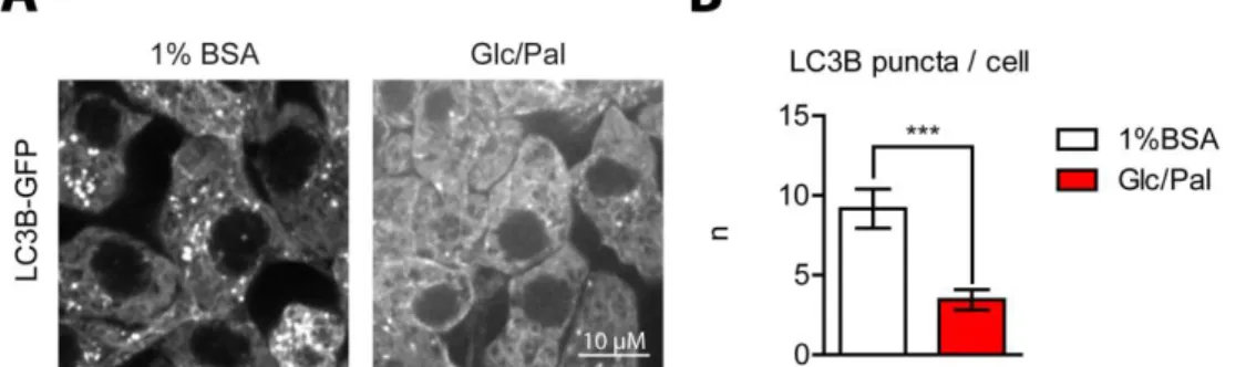 Figure 20 : LC3B-GFP dots decrease under glucolipotoxic conditions. (A) Representative  pictures of LC3B-GFP expressing INS1 cells subjected to control (1%BSA) or glucolipotoxic  conditions (Glc/Pal) for 40h