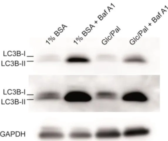 Figure  21 :  Glucolipotoxic  treatment  decreases  the  levels  of  LC3B  II.  Western  blot  of  lysates  from  INS1  cells  treated  with  1%  bovine  serum  albumin  (BSA)  or  glucose/palmitate  (Glc/Pal) in the presence and absence of bafilomycin  A1