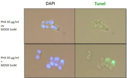 Figure 45. Le MDEB induit une mort cellulaire par apoptose dans les  cellules Jurkat stimulées 