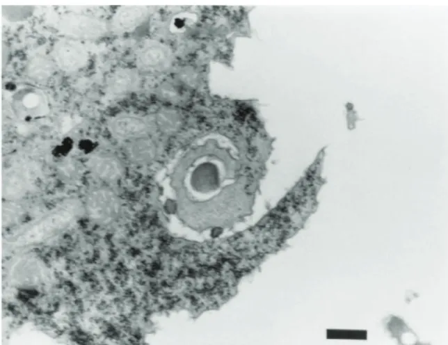 Figure 3. Internalisation de L. pneumophila par Acanthamoeba castellanii par « coiling  phagocytosis » après 30 minutes de co-incubation (58) 
