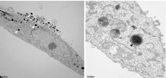 Figure 12. Photographie en microscopie électronique de S. aureus intra-cellulaires (flèches) après infection  d'ostéoblastes humains de lignée MG63