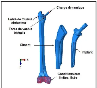 Tableau 3.1: Propriétés mécaniques des composants de la prothèse totale de hanche. [59] 