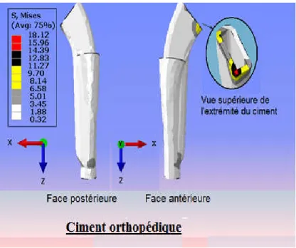 Figure 4.11: Contours de contraintes de Von Mises dans le ciment, durant la marche 