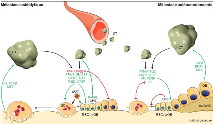 Figure 13. Le cercle vicieux dans les métastases de type ostéolytique et ostéoblastique