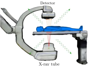 Figure 4.1: Representation of the X-ray imaging process and simulated output radiogra- radiogra-phy.