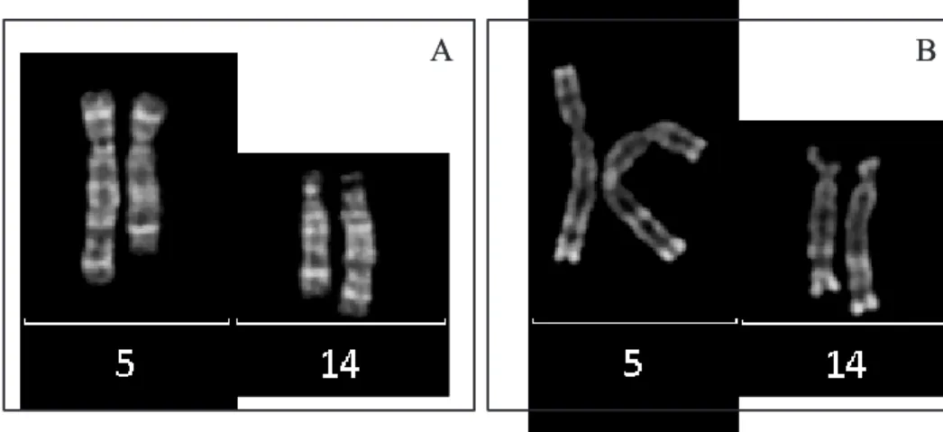Figure 11 : Représentation des chromosomes 5 et 14 et des dérivés 5 et 14 de la translocation  t(5;14) en bandes G (A) et R (B) 
