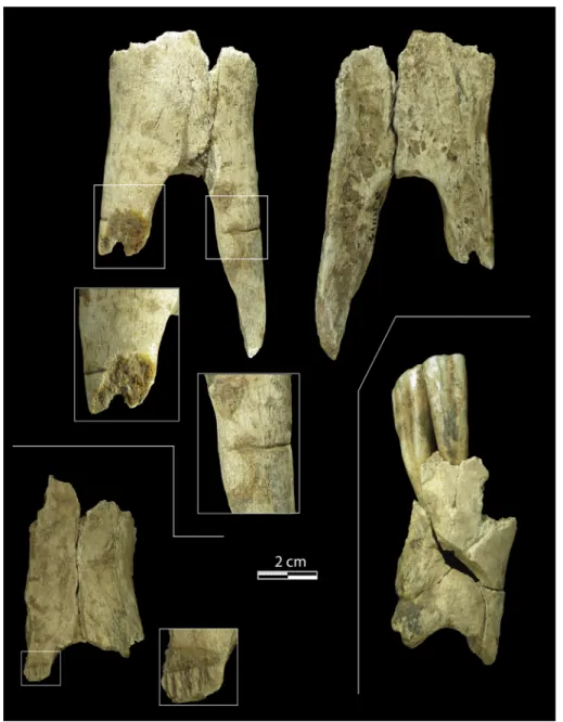 Fig. 11. Sawing marks, deep incisions, and perforation.