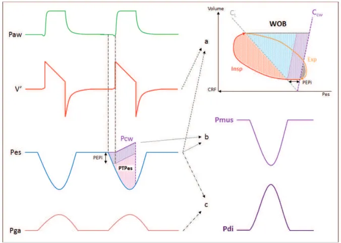 Figure 2 Calcul des principaux indices d’effort respiratoire. La partie gauche de la figure représente de haut  en  bas  les  courbes  de  pression  des  voies  aériennes  (Paw),  de  débit  des  voies  aériennes  (V’),  de  pression  œsophagienne  (Pes)  