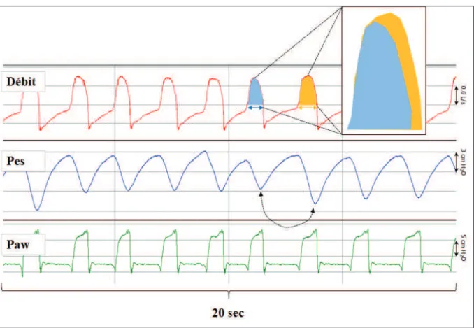 Figure  4  Effets  d’une  modification  de  l’effort  inspiratoire  en  VSAI.  Les  courbes  représentent  (de  haut  en  bas) : le débit des voies aériennes, la pression œsophagienne (Pes), et la pression des voies aériennes (Paw)