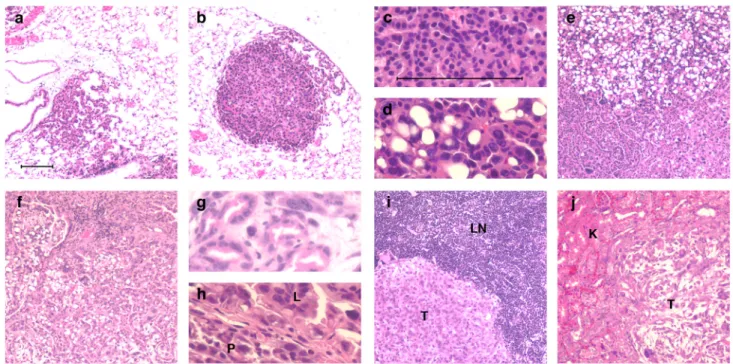 Figure 4. Tumor progression and histopathological phenotype in KP model