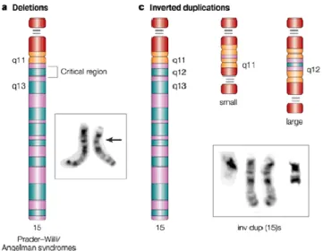 Figure 5 : Illustration du chromosome 15 ainsi que ses remaniements chromosomiques associés aux TSA  (47) 