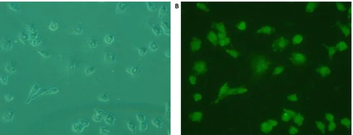 Figure 6: Vue de cellules cancéreuses traitées avec le complexe 133 par épifluorescence sous A)  lumière blanche, B) lumière UV à λ = 365 nm 