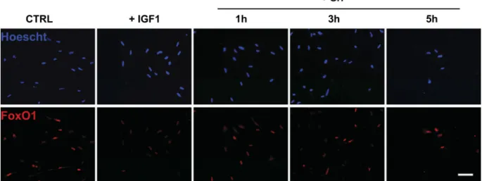 Fig. 6. Effect of GH on FoxO1 localization in primary culture of trout muscle cells. Seven-day-old cells were serum starved for 24 h (CTRL) and then stimulated or not with 100 nM of trout IGF-I for 3 h or 0.5 nM of trout GH for 1, 3, or 5 h