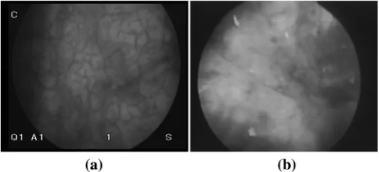 Fig. 1. Examples of typical images extracted from cystoscopic acquisitions.