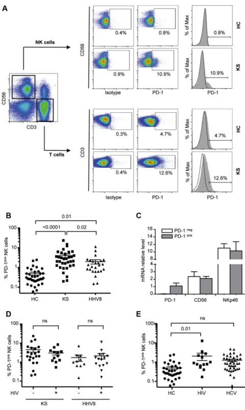 Figure 1: PD-1 is expressed on a fraction of CD56dim NK cells in KS patients.  NK cells were gated as follows: singlets,  lymphocytes, CD3-CD56+ NK cells, and 7AAD- (live cells)